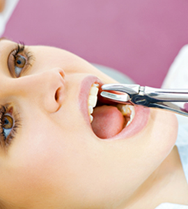 Painless Tooth Removal