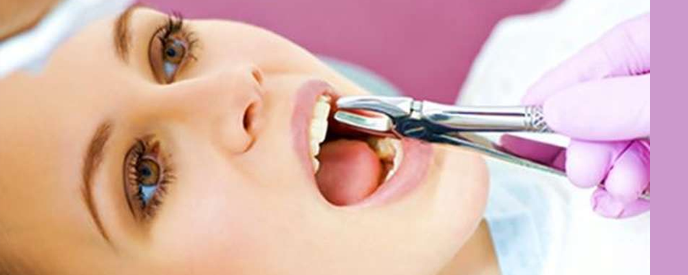 Painless Tooth Removal